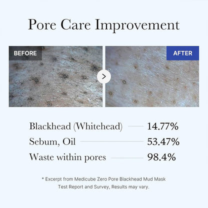 Medicube Zero Pore Blackhead Mud Facial Mask