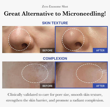Medicube Zero 1DAY Exosome Shot