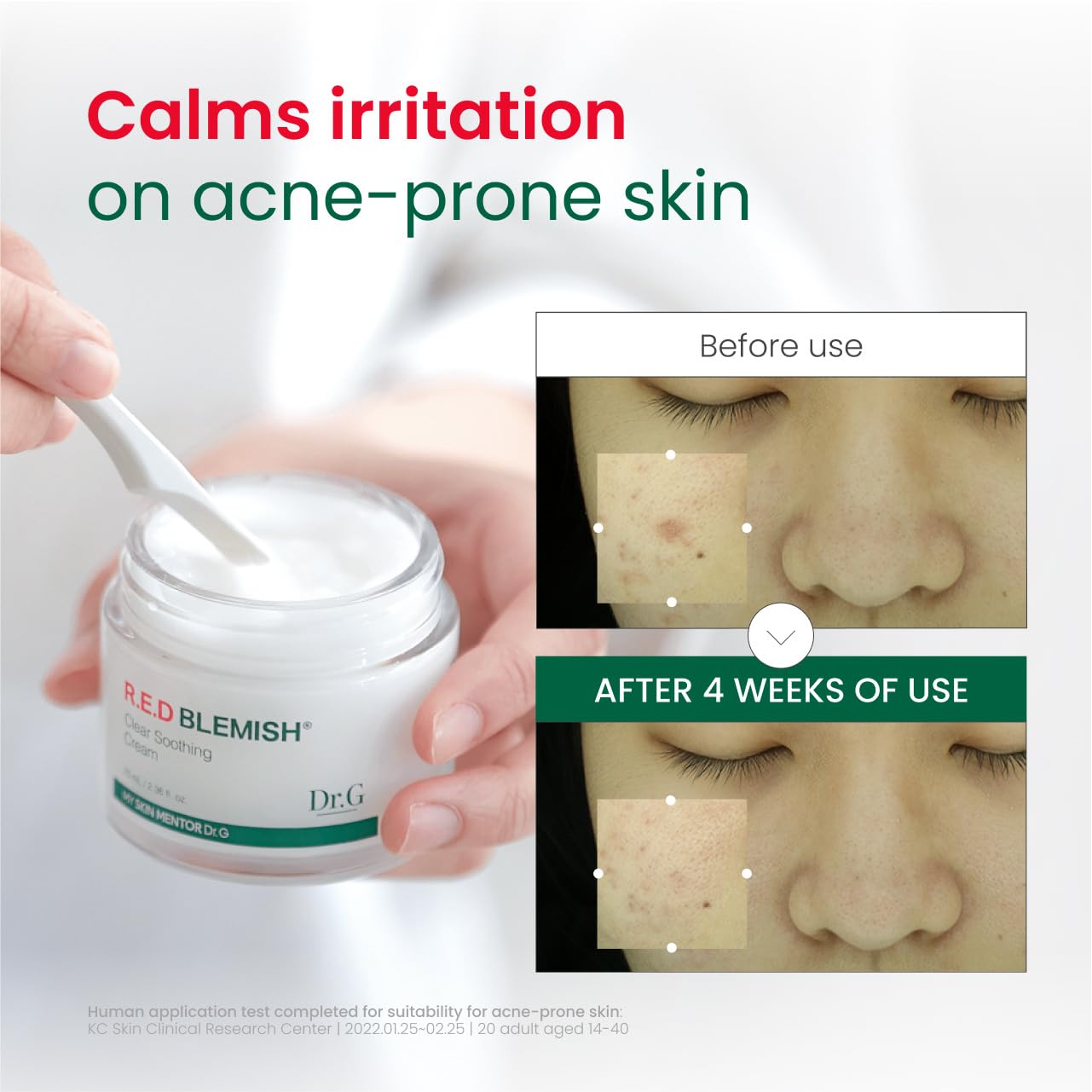 Dr.G RED Blemish Clear Soothing Cream