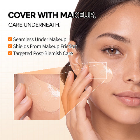Dr. Melaxin Ultra Thin Pimple Patch Duo Pack (2 x 72 Patches)