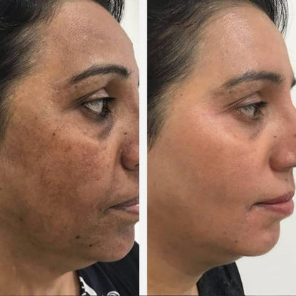 Medicube Collagen Night Wrapping Peel Off Mask